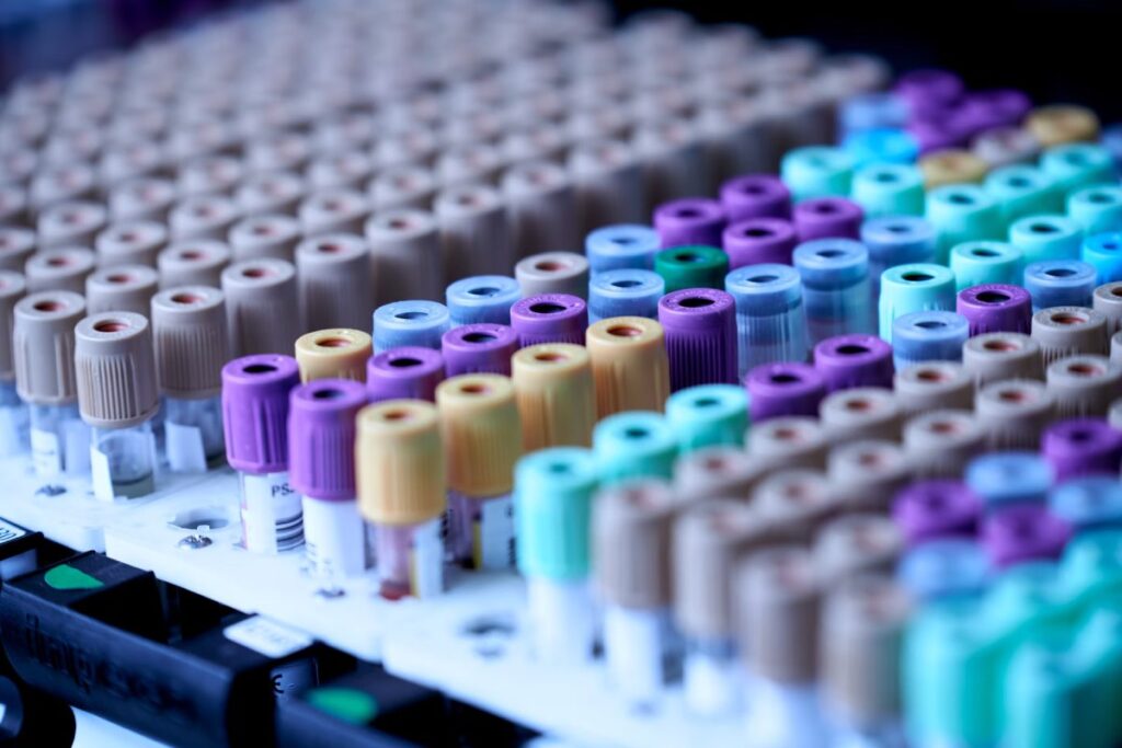 Image montrant un appareil de diagnostic. Un équipement de laboratoire pour faire des analyses.
