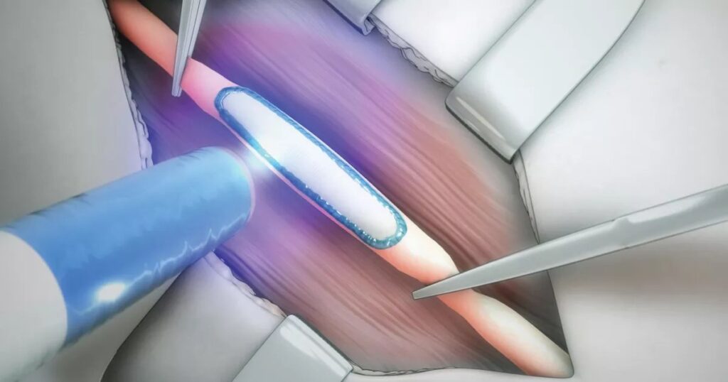 Image montrant un appareil medtech.