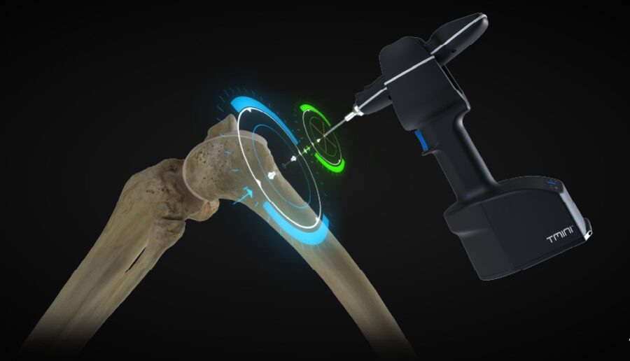 Image montrant l'appareil chirurgical orthopédique THINK Surgical.